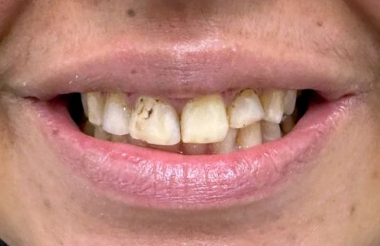 Before - 212 Dental Studio