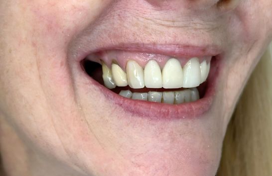 After -212 Dental Studio