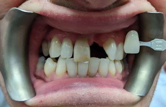 After -212 Dental Studio