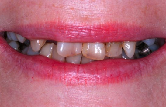 Before - 212 Dental Studio