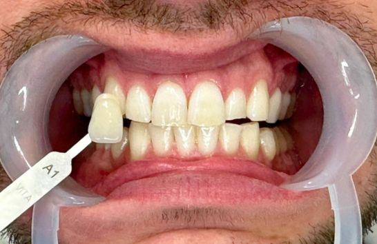 After -212 Dental Studio