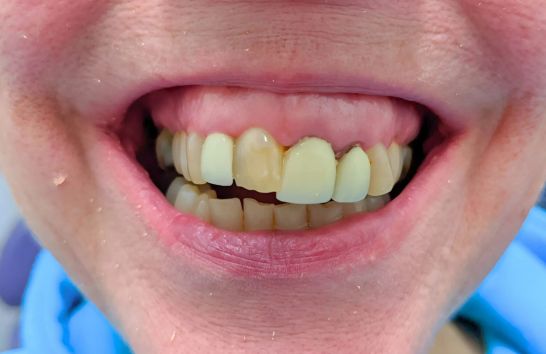 Before - 212 Dental Studio