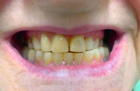 Before - 212 Dental Studio