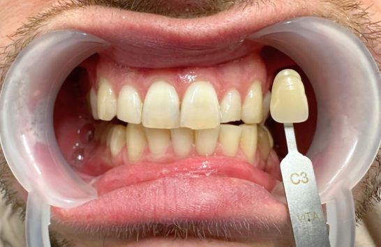 Before - 212 Dental Studio