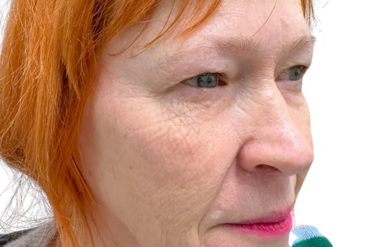 Before - 212 Dental Studio