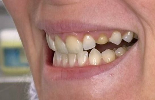 Before - 212 Dental Studio